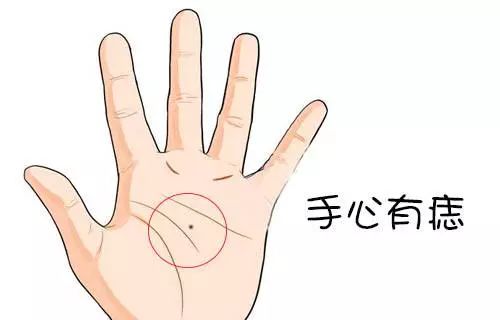 男女手掌有痣代表什么