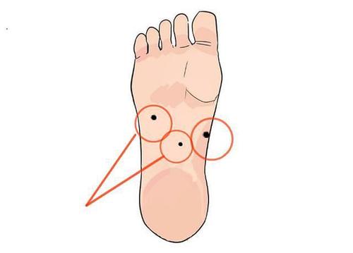 脚底长痣有哪些含义 脚底不同位置长痣痣相分析