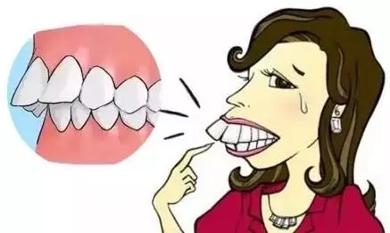  龅牙的人性格怎么样 龅牙面相解析