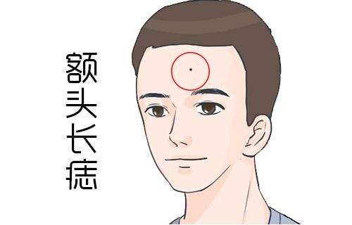男人额头上有痣代表着什么？